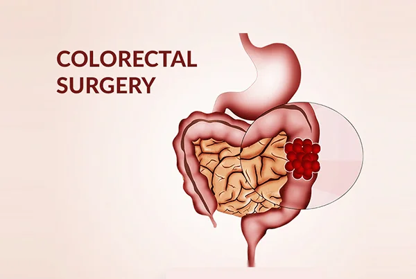 G.I. Surgery