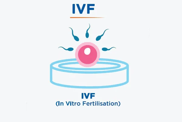 IVF